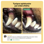 Dental Bright – efekty przed i po