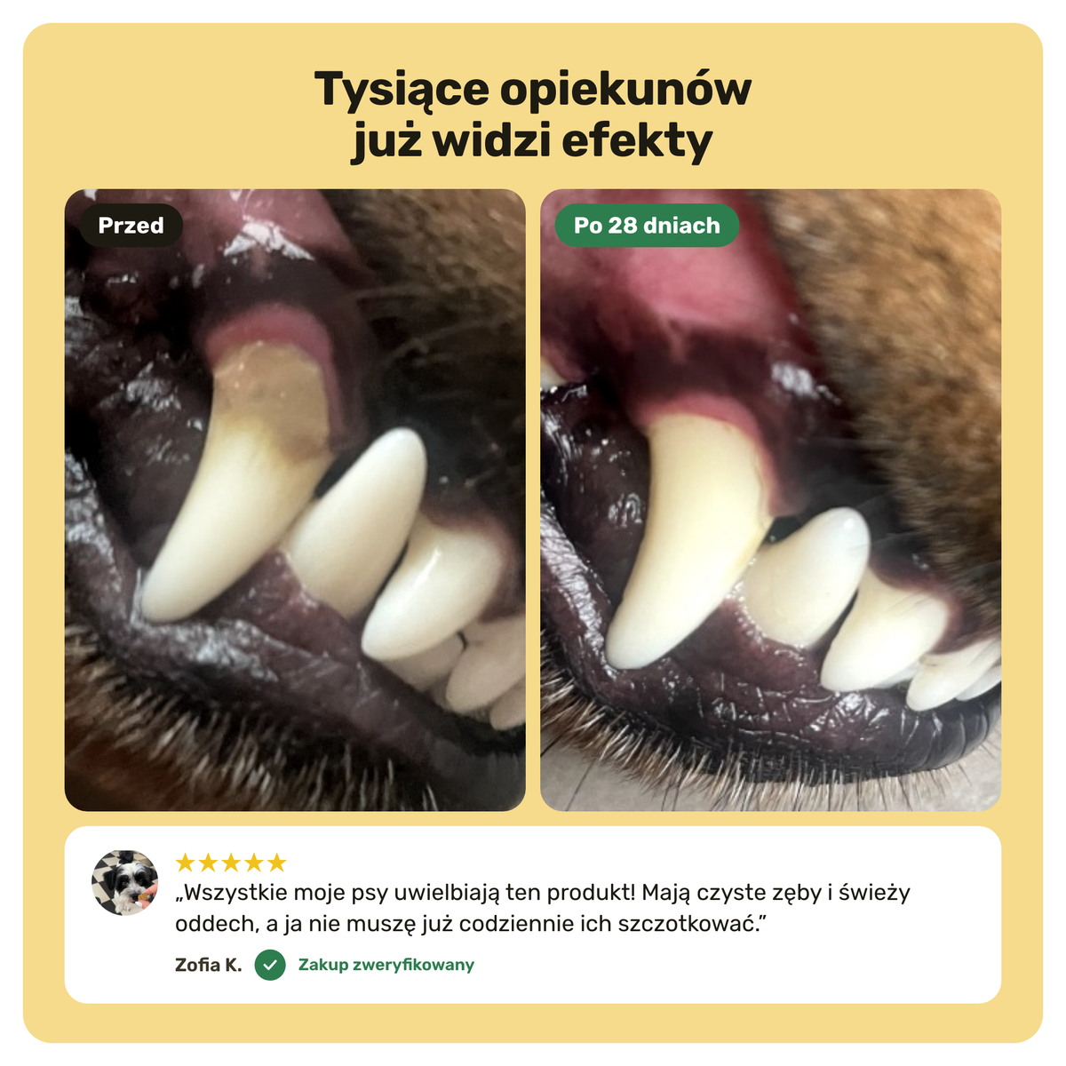 Dental Bright – efekty przed i po